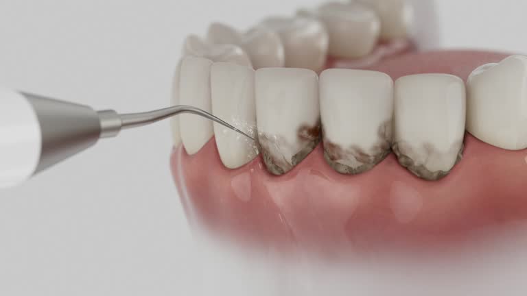 Trusted Invisalign Clear Aligners service in Lowell, IN - Dentist Open Now